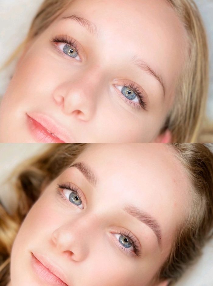 Browlamination-3